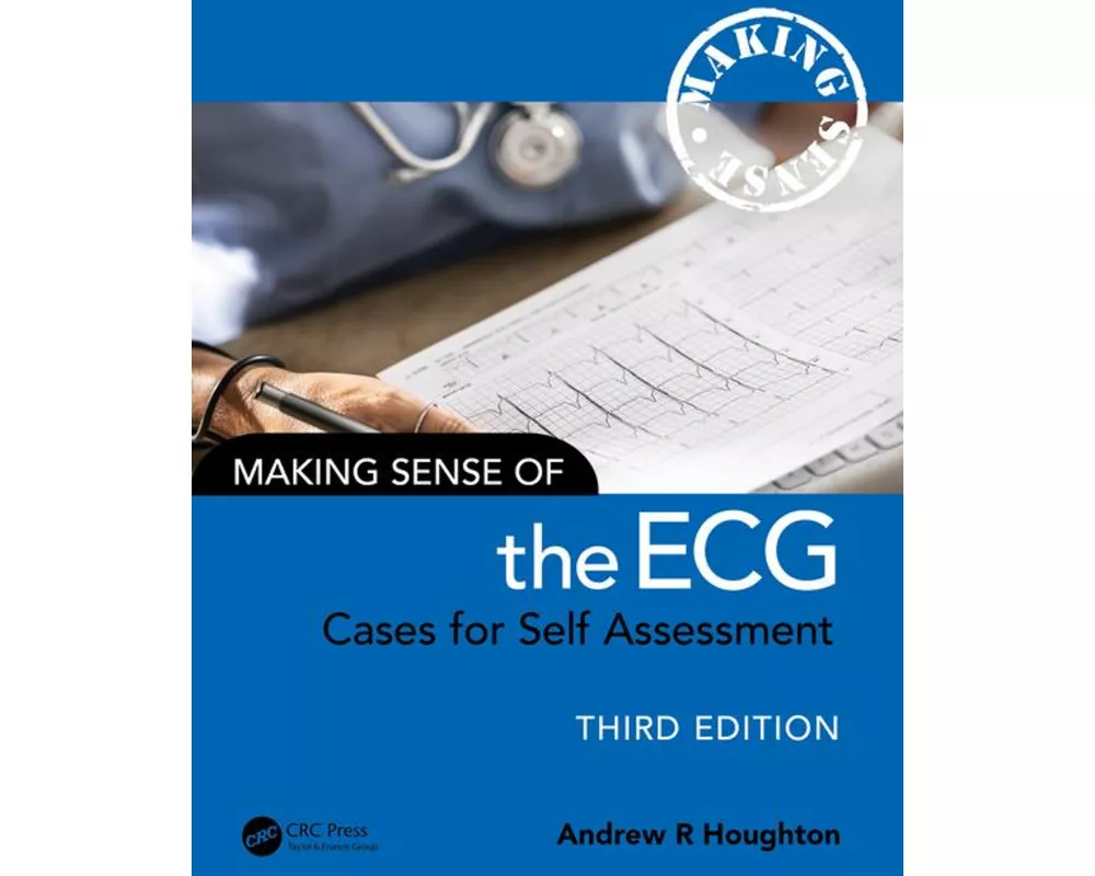 Making Sense of the ECG