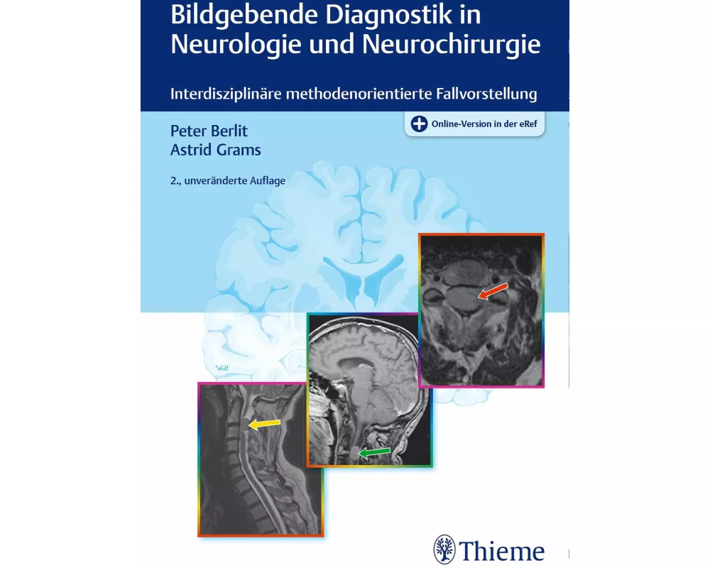 Bildgebende Diagnostik in Neurologie und Neurochirurgie