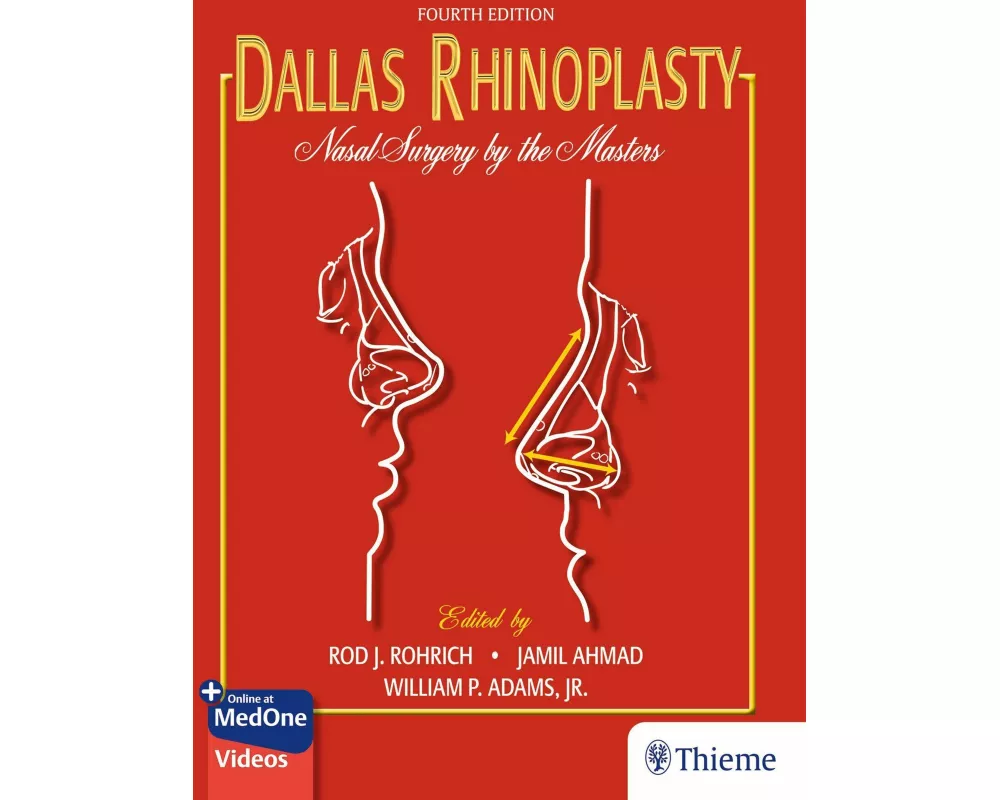 Dallas Rhinoplasty