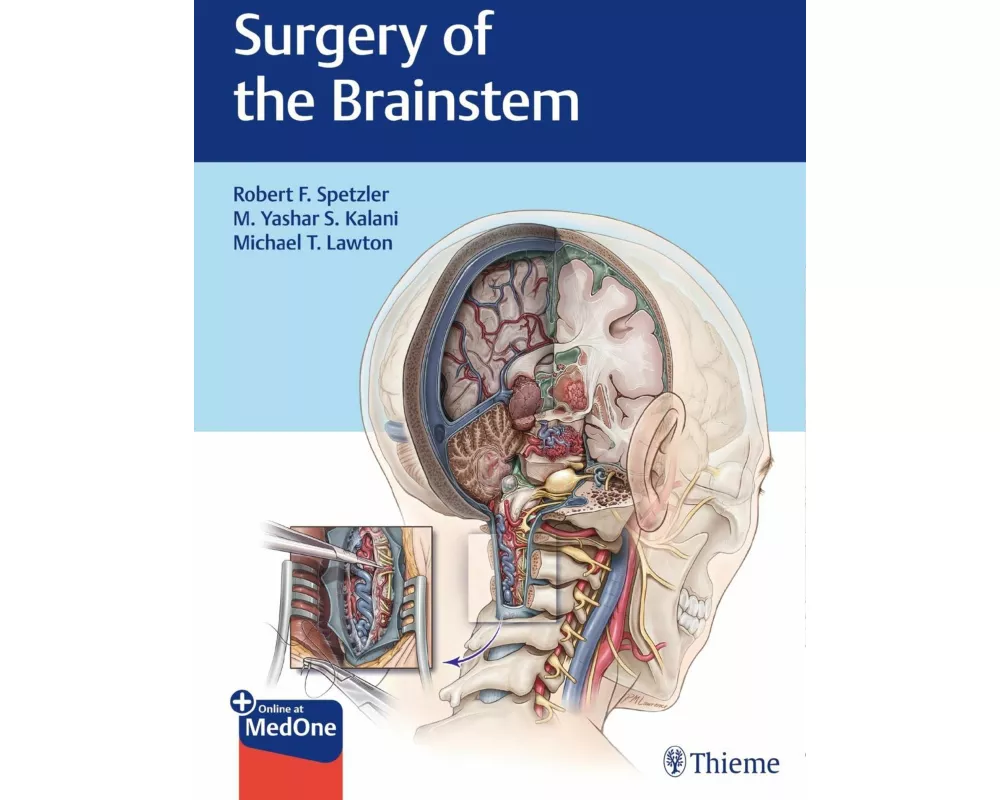 Surgery of the Brainstem