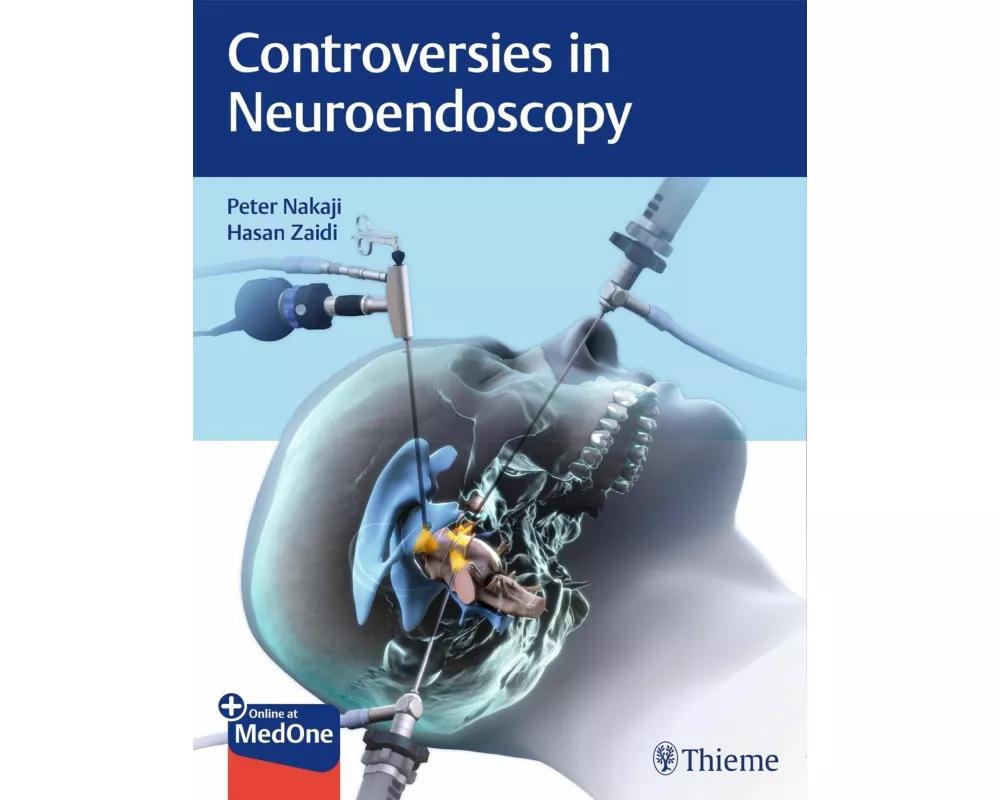 Controversies in Neuroendoscopy