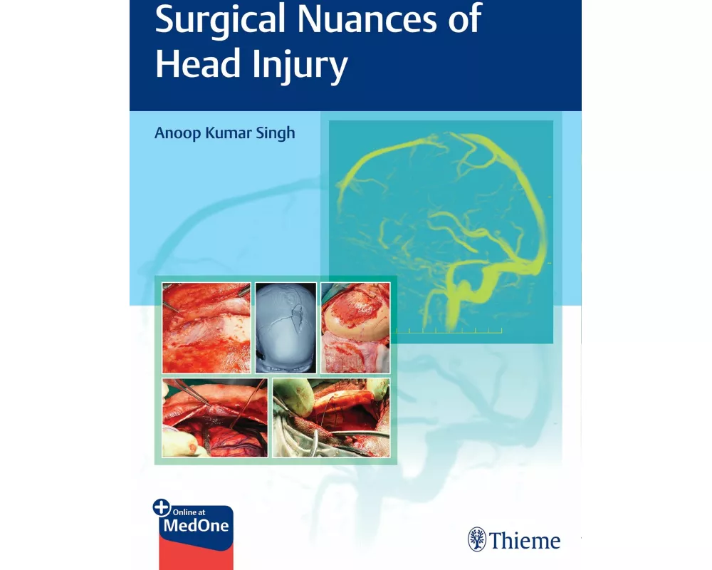 Surgical Nuances of Head Injury