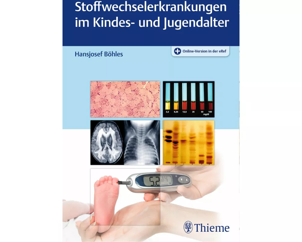Stoffwechselerkrankungen im Kindes- und Jugendalter