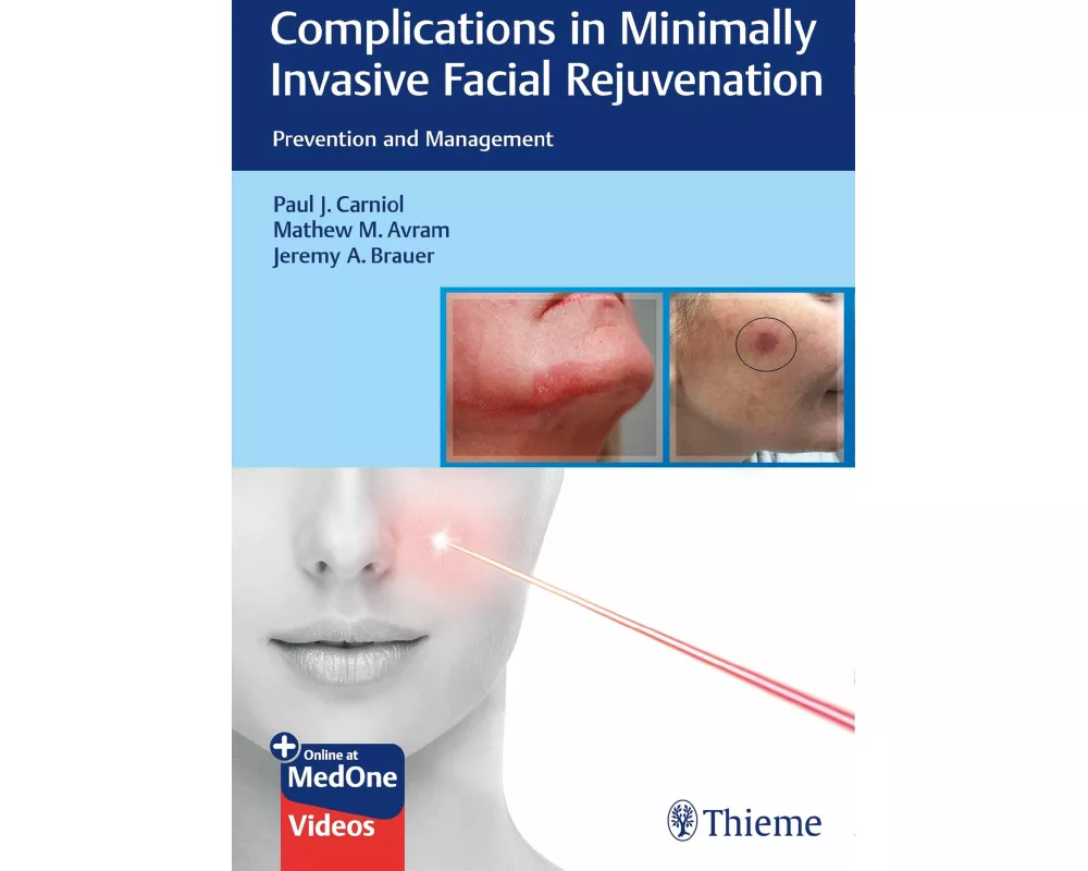 Complications in Minimally Invasive Facial Rejuvenation