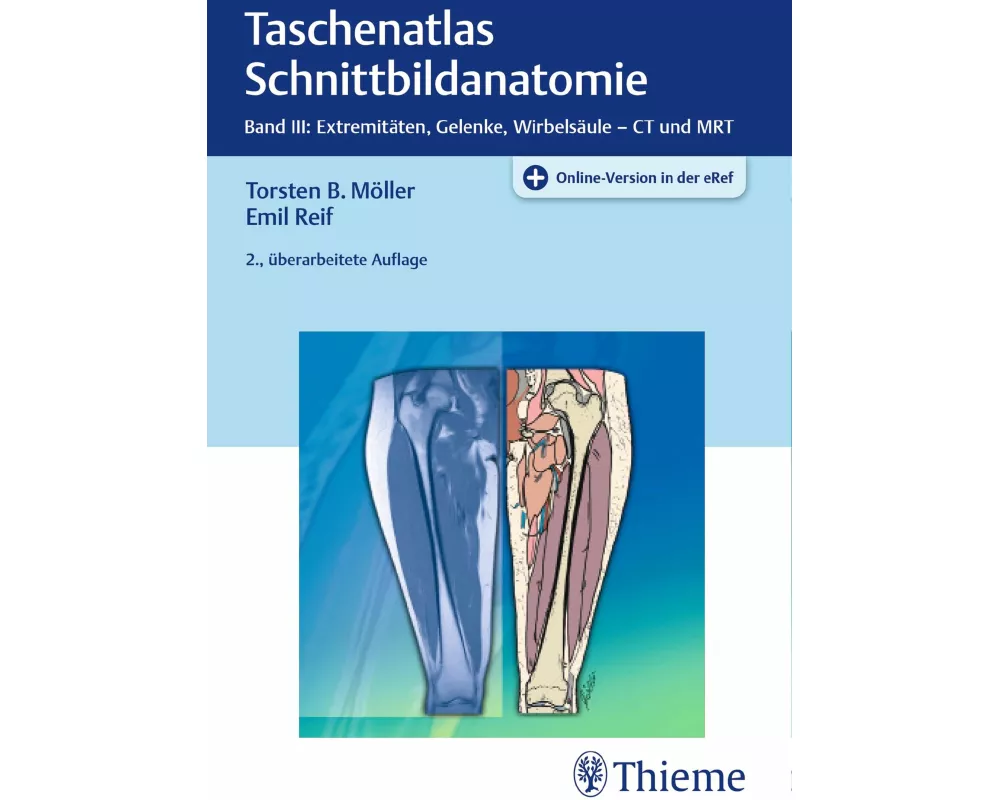 Taschenatlas Schnittbildanatomie