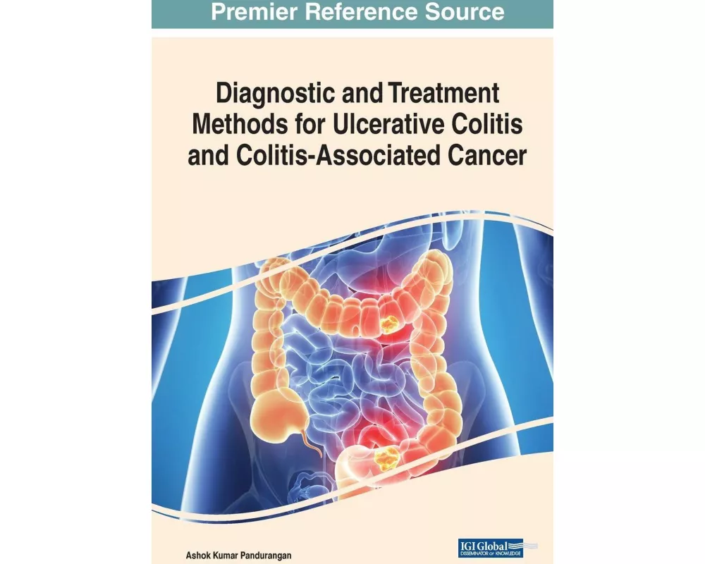 Diagnostic and Treatment Methods for Ulcerative Colitis and Colitis-Associated Cancer