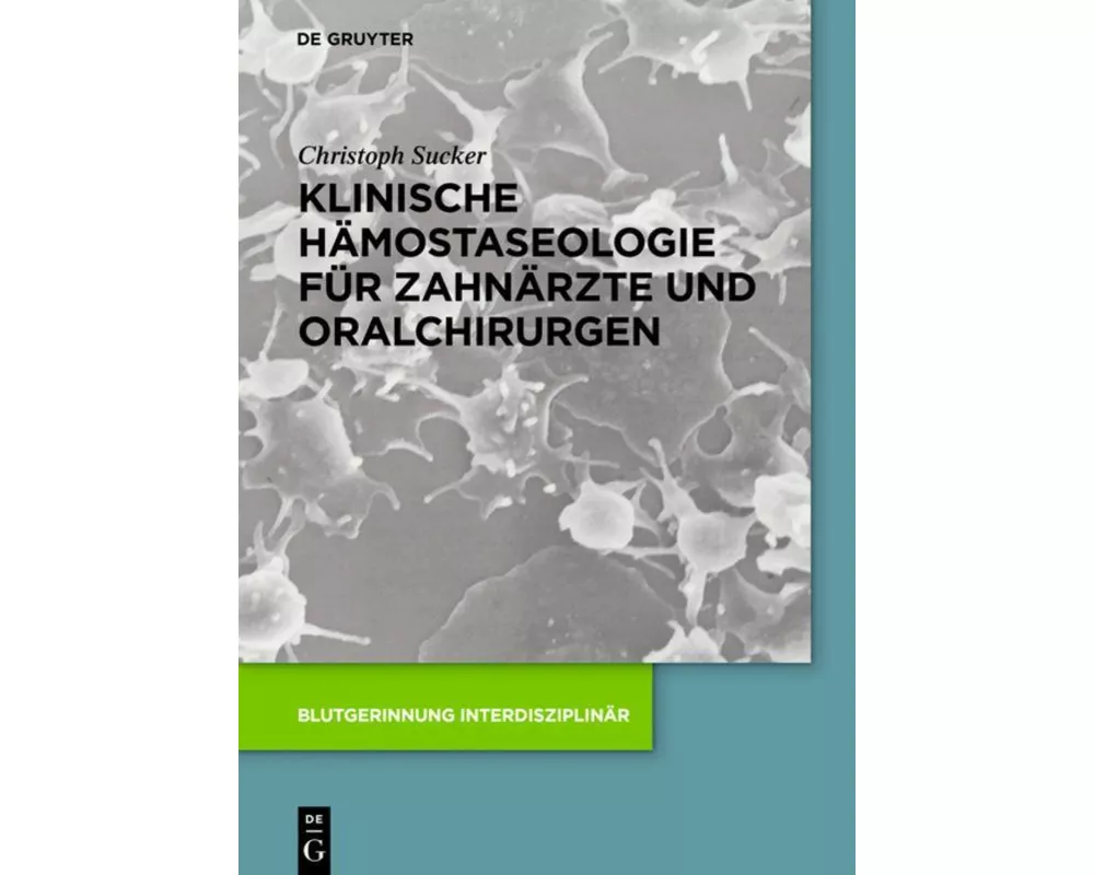 Klinische Hämostaseologie für Zahnärzte und Oralchirurgen