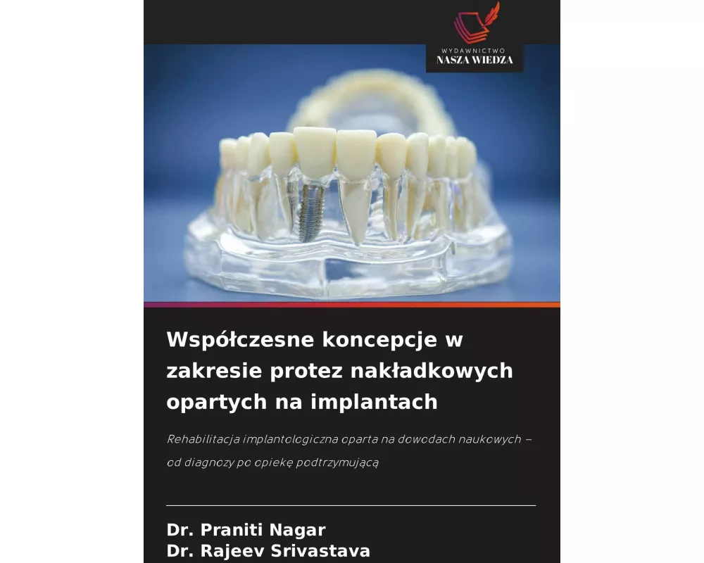 Wspó¿czesne koncepcje w zakresie protez nak¿adkowych opartych na implantach