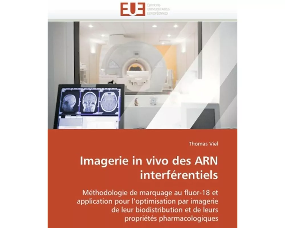 Imagerie in vivo des ARN interférentiels