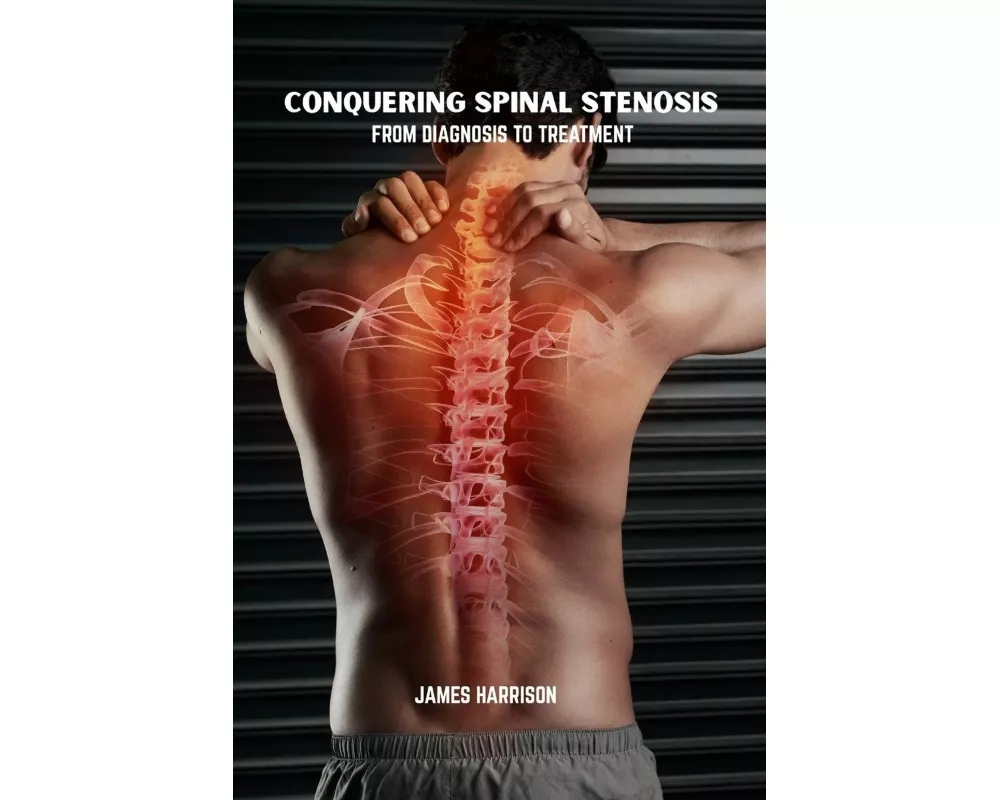 Conquering spinal stenosis