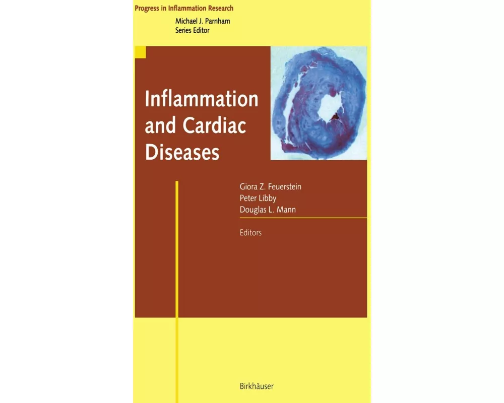 Inflammation and Cardiac Diseases