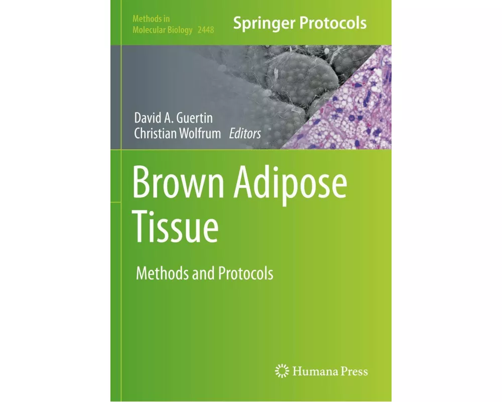 Brown Adipose Tissue