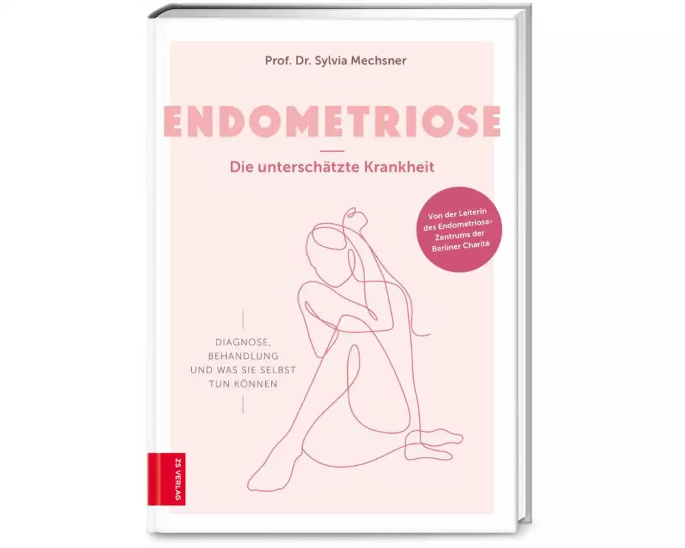 Endometriose – Die unterschätzte Krankheit