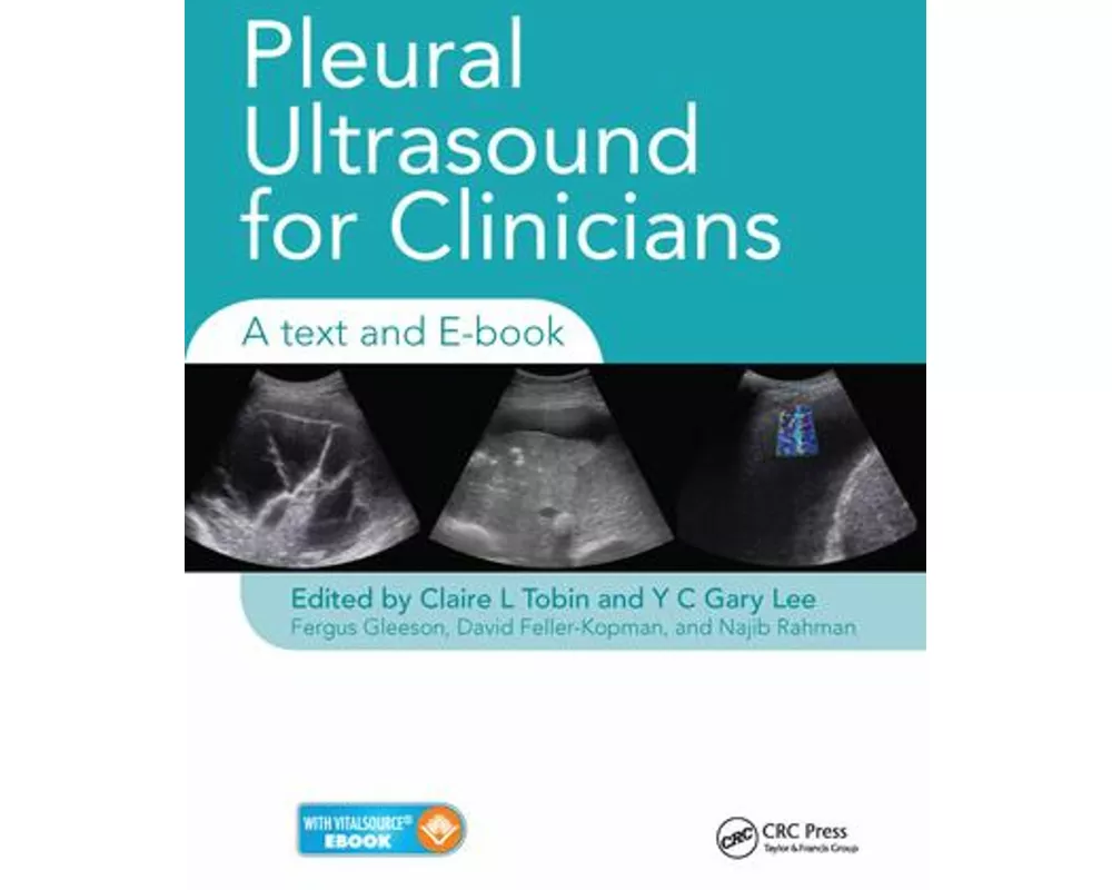 Pleural Ultrasound for Clinicians