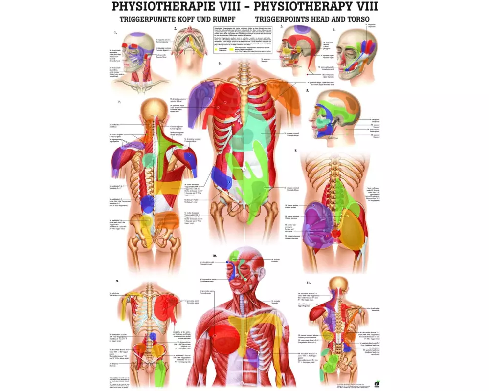 Rüdiger Anatomische Lehrtafel Triggerpunkte Kopf & Rumpf 50 x 70 cm