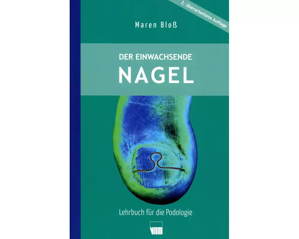 Der eingewachsenen Nagel