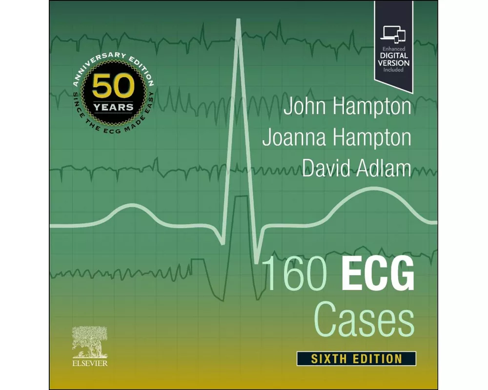 160 ECG Cases