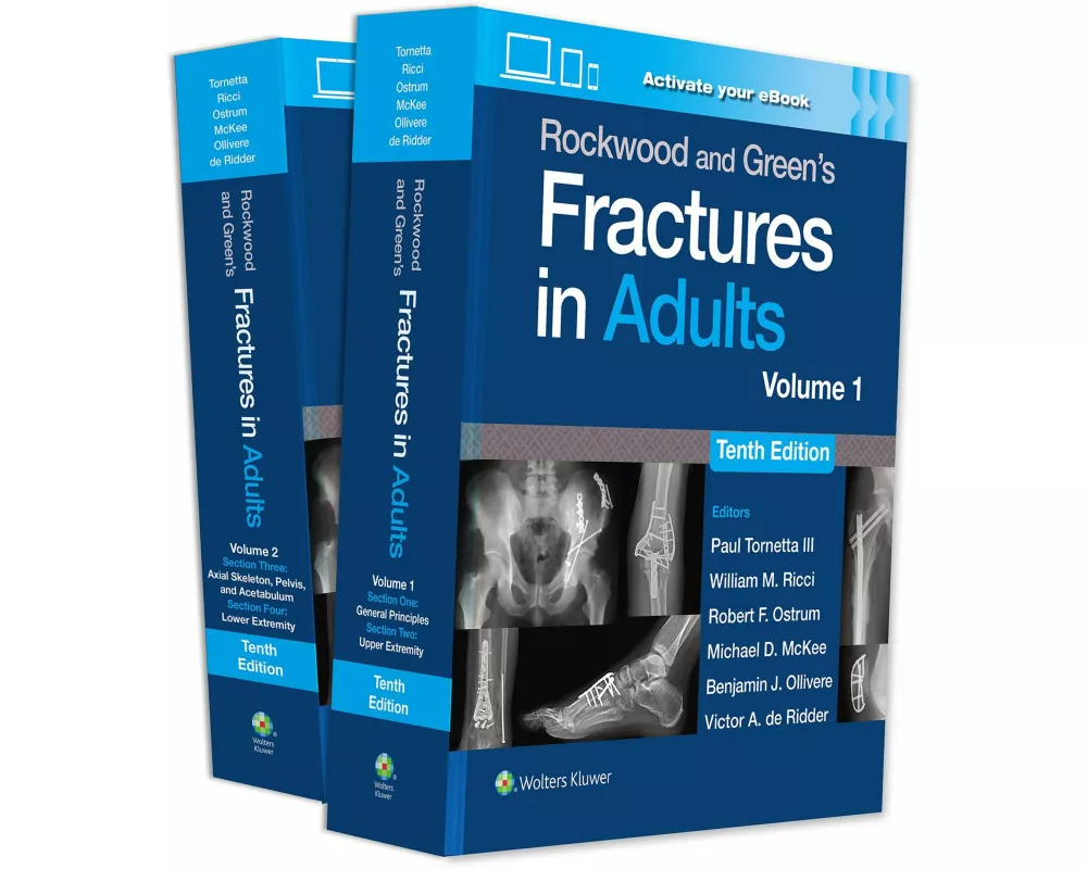Rockwood and Green's Fractures in Adults: Print + eBook with Multimedia