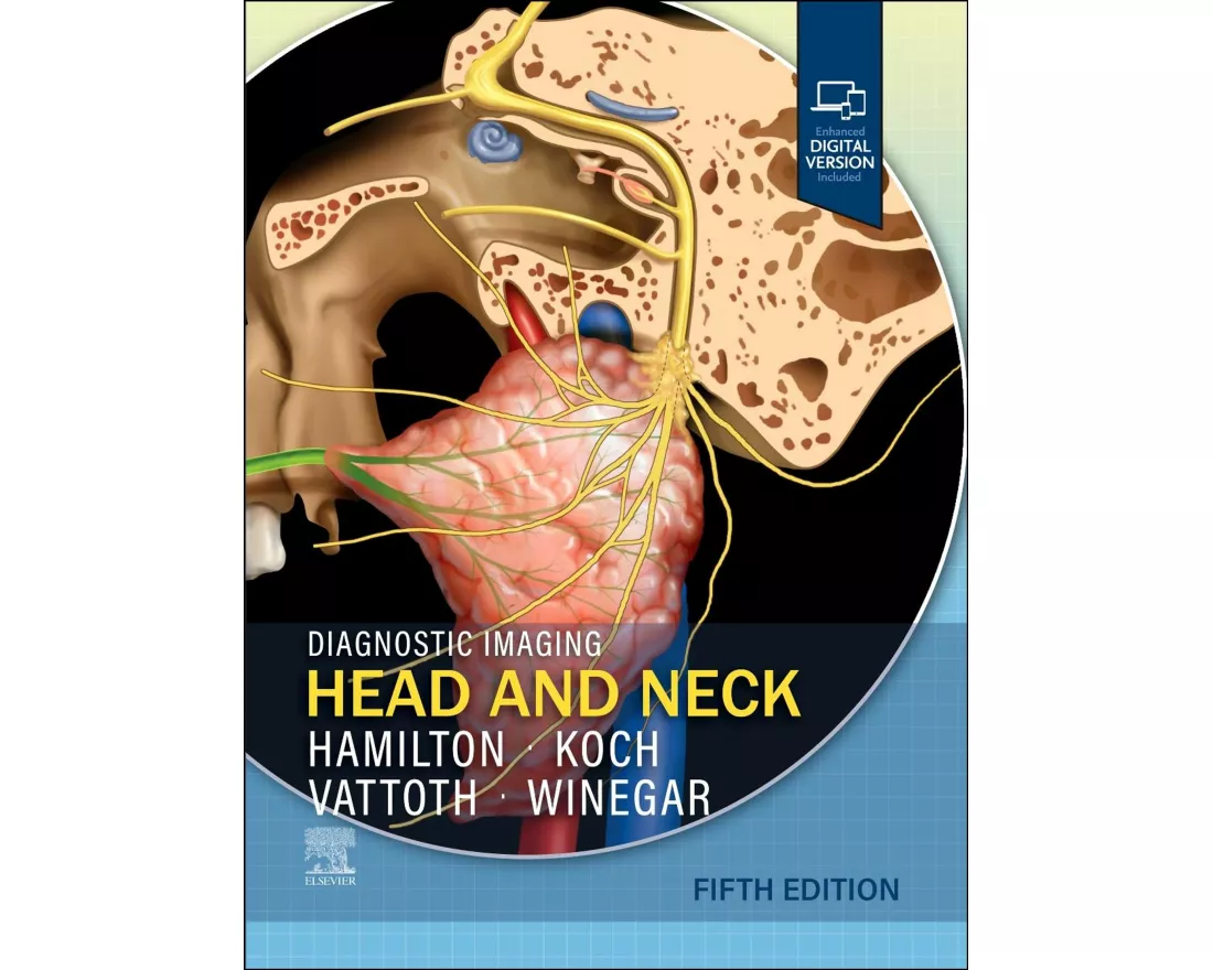 Diagnostic Imaging: Head and Neck