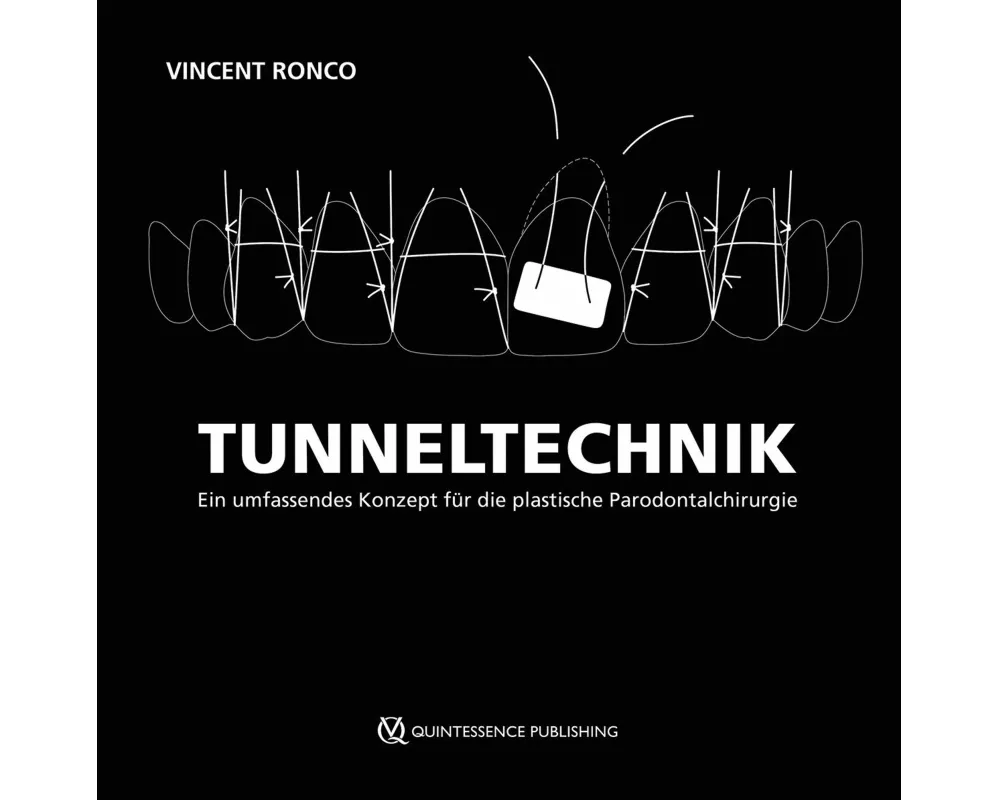 Tunneltechnik