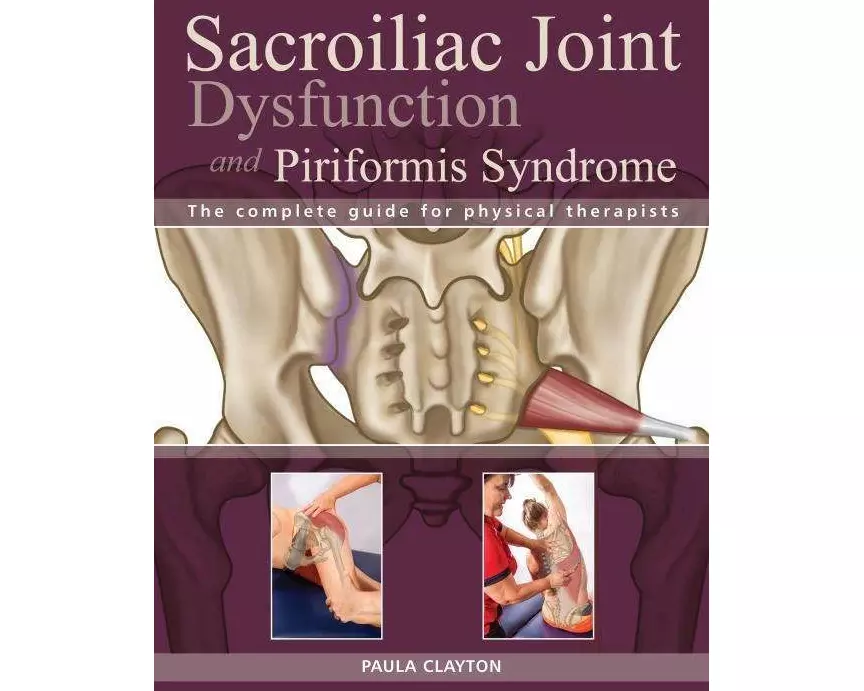 Sacroiliac Joint Dysfunction and Piriformis Syndrome