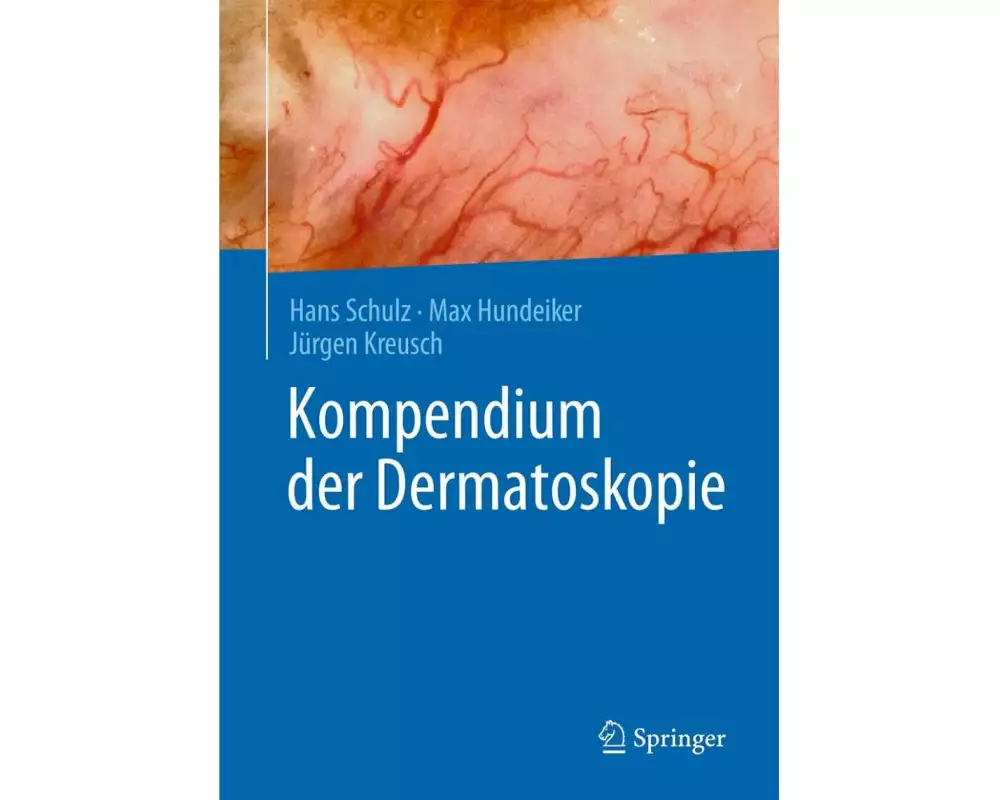 Kompendium der Dermatoskopie