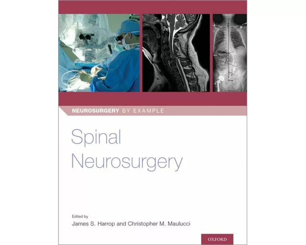 Spinal Neurosurgery