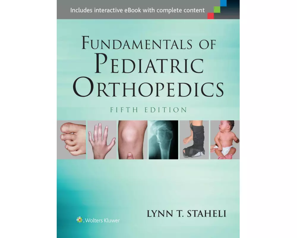 Fundamentals of Pediatric Orthopedics