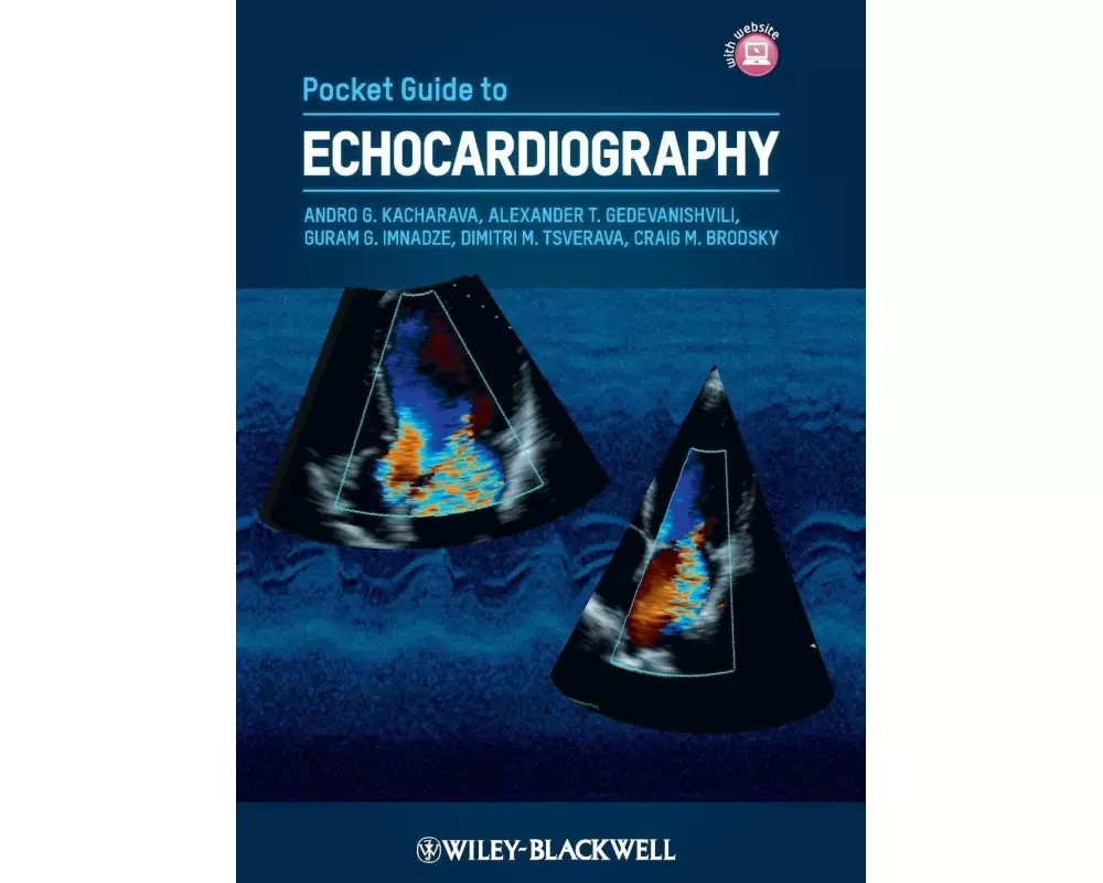 Pocket Guide to Echocardiography