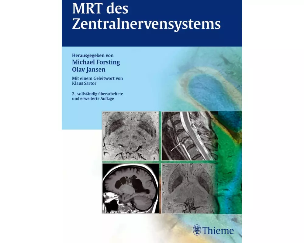 MRT des Zentralnervensystems