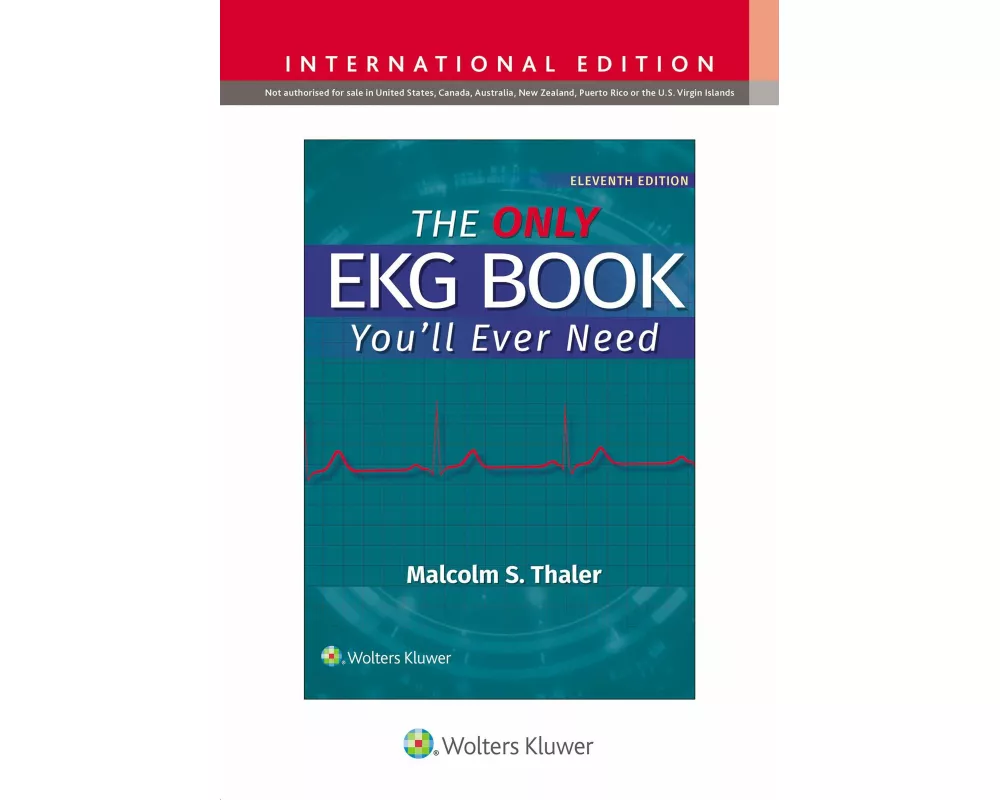The Only EKG Book You'll Ever Need