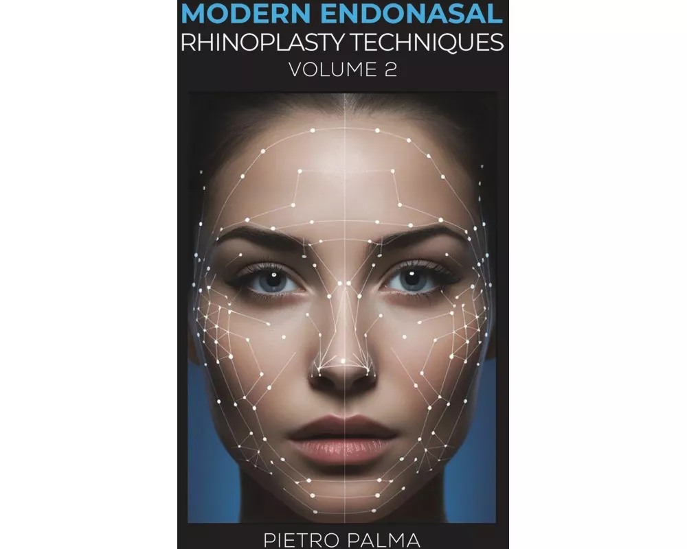 Modern Endonasal Rhinoplasty Techniques – Volume 2