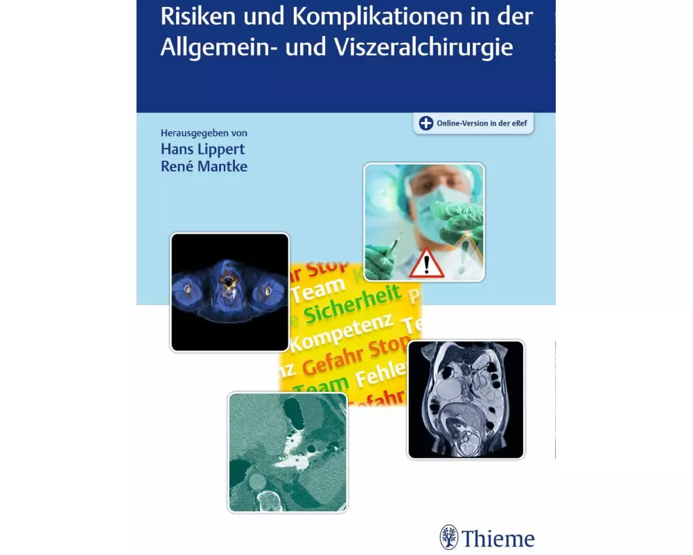 Risiken und Komplikationen in der Allgemein- und Viszeralchirurgie