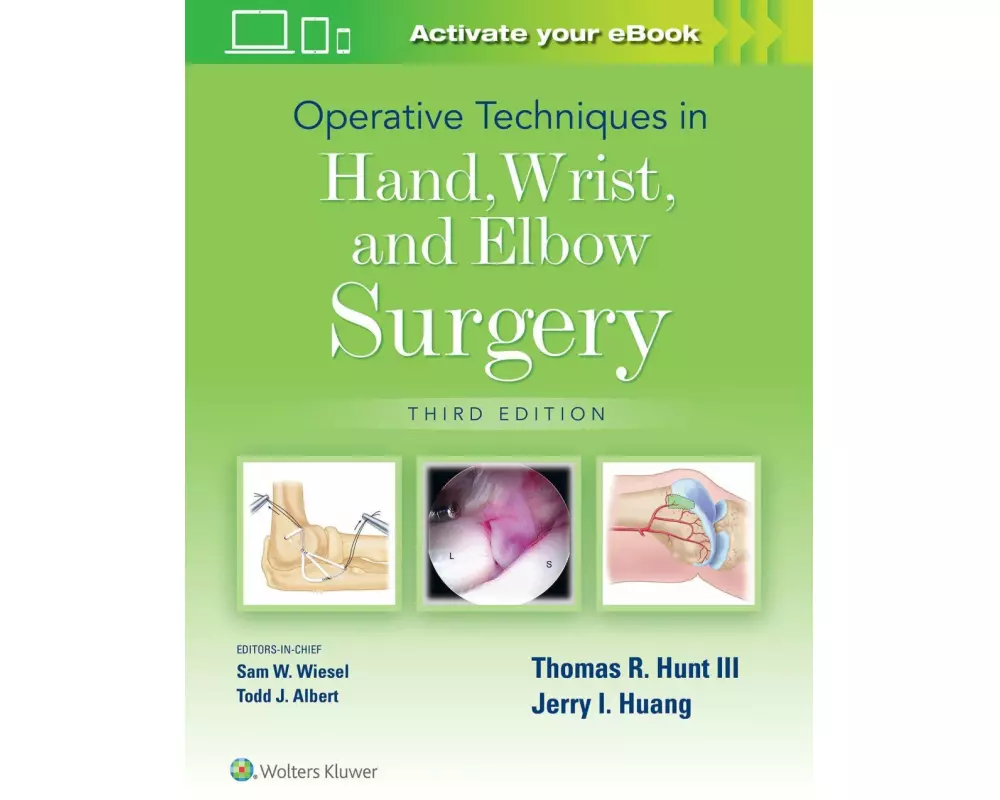 Operative Techniques in Hand, Wrist, and Elbow Surgery