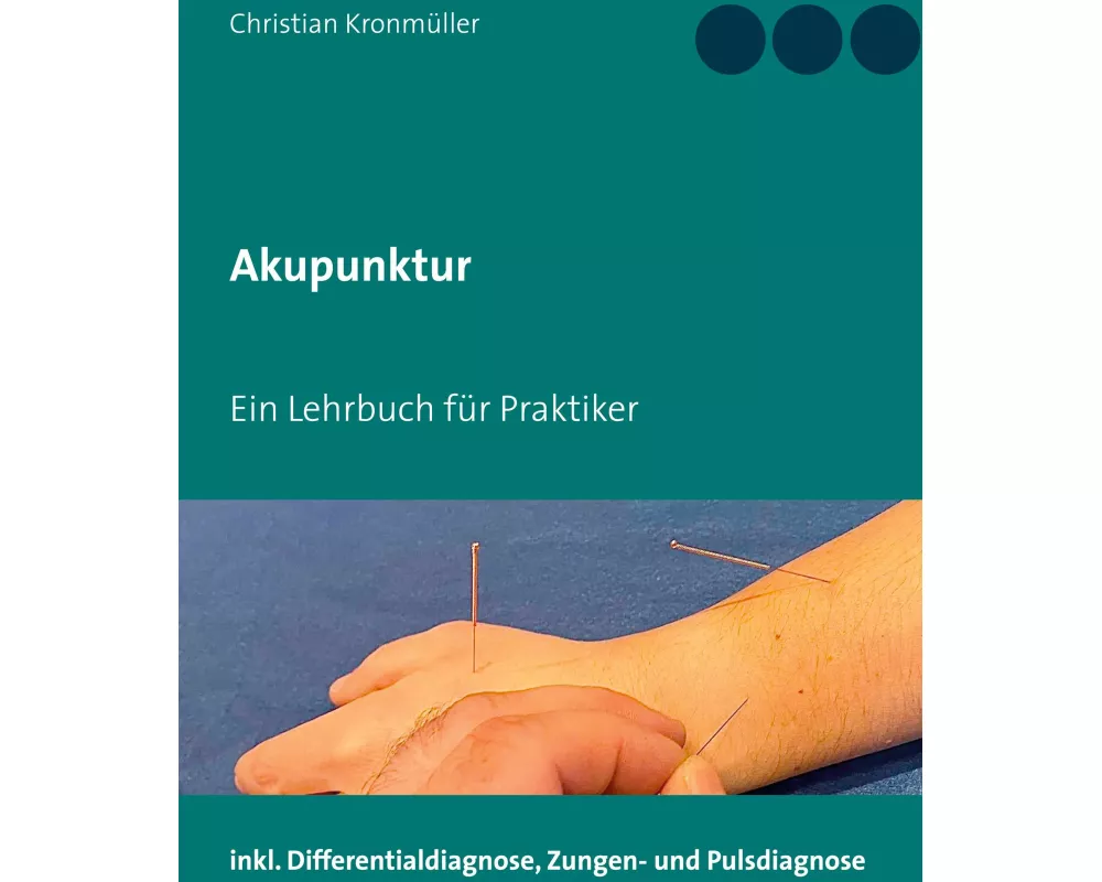 Akupunktur