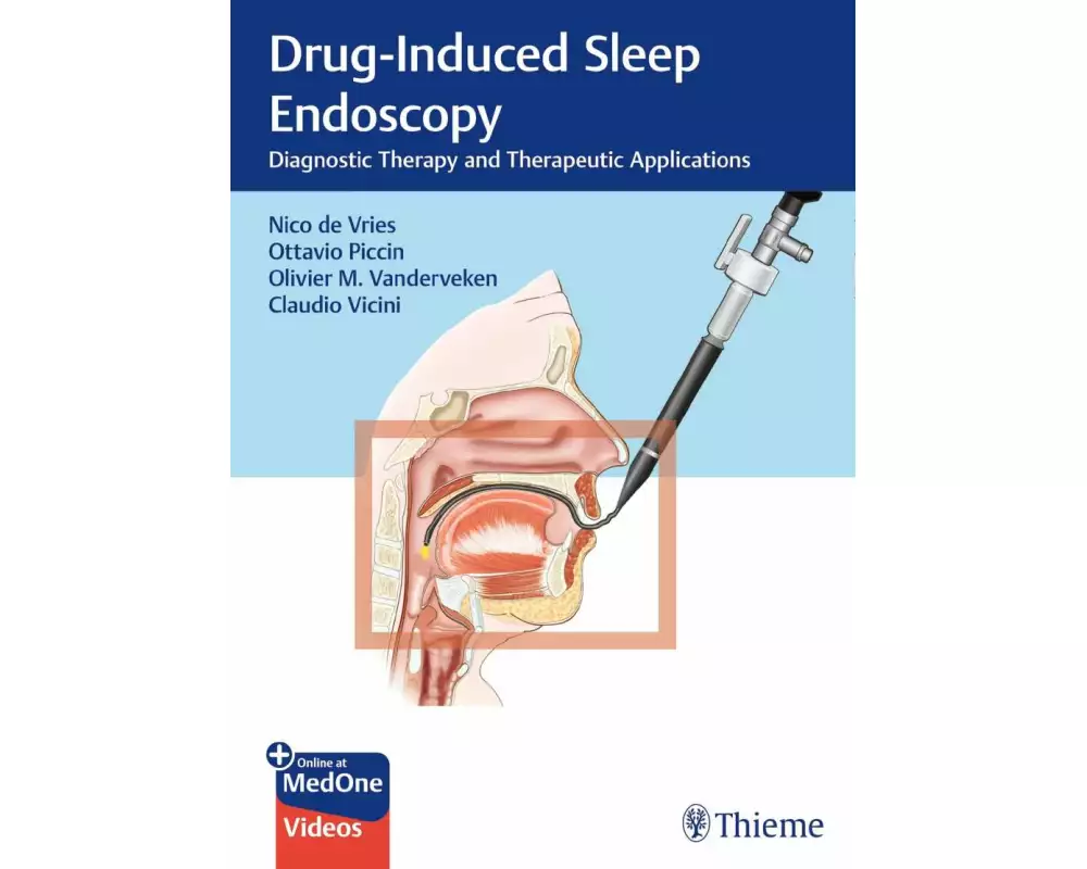 Drug-Induced Sleep Endoscopy