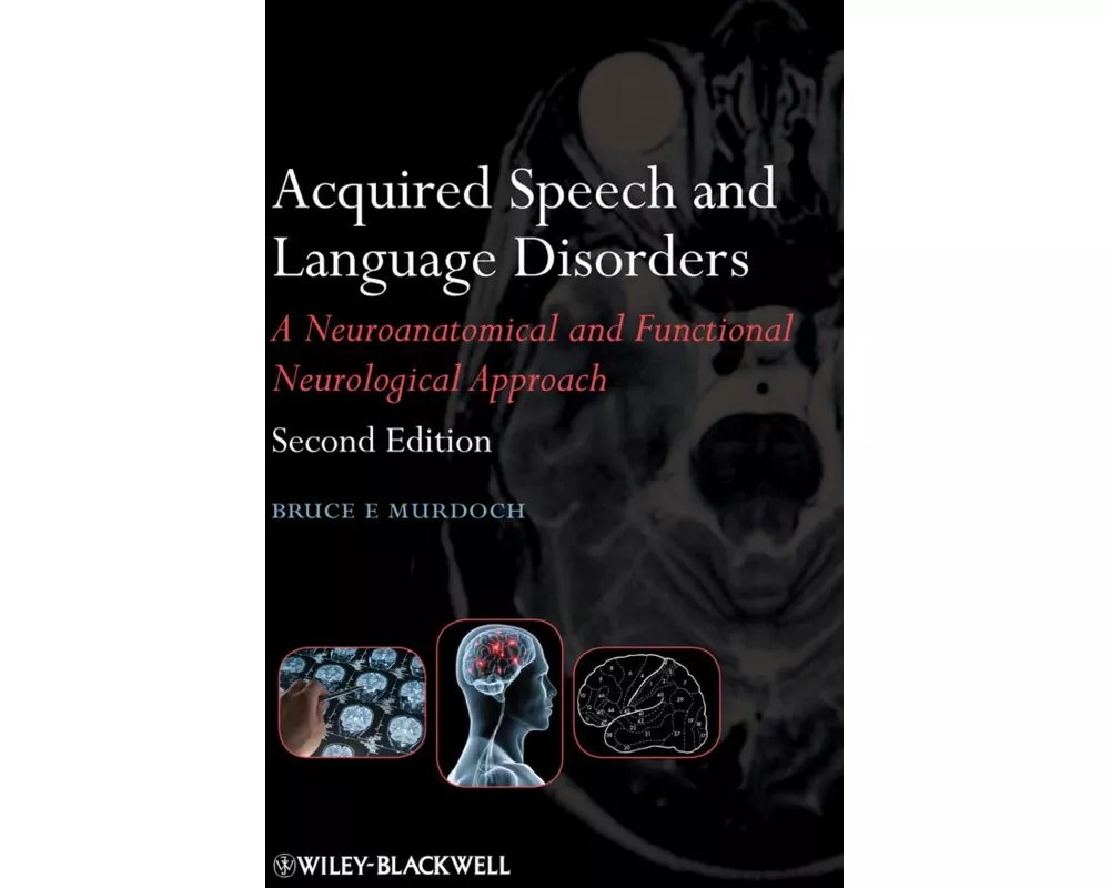 Acquired Speech and Language Disorders