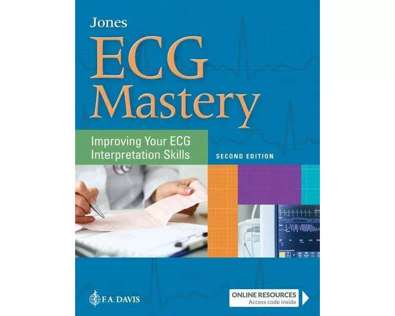 ECG Mastery