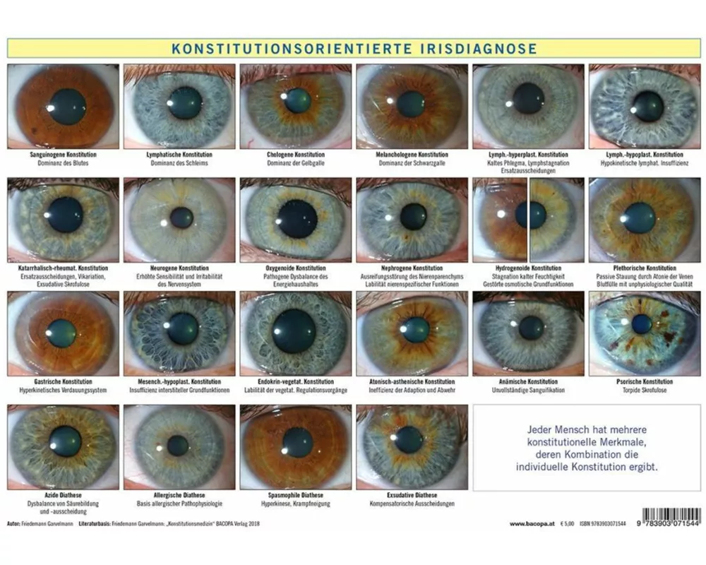 Konstitutionsorientierte Irisdiagnose