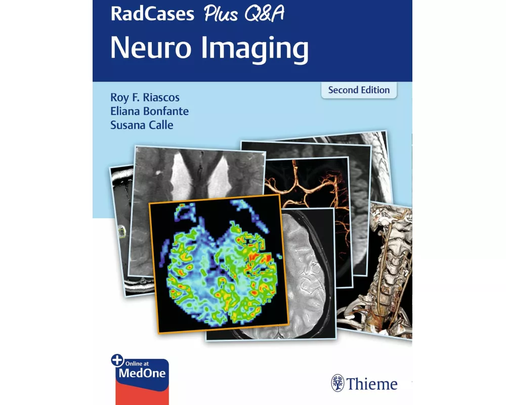 RadCases Plus Q&A Neuro Imaging