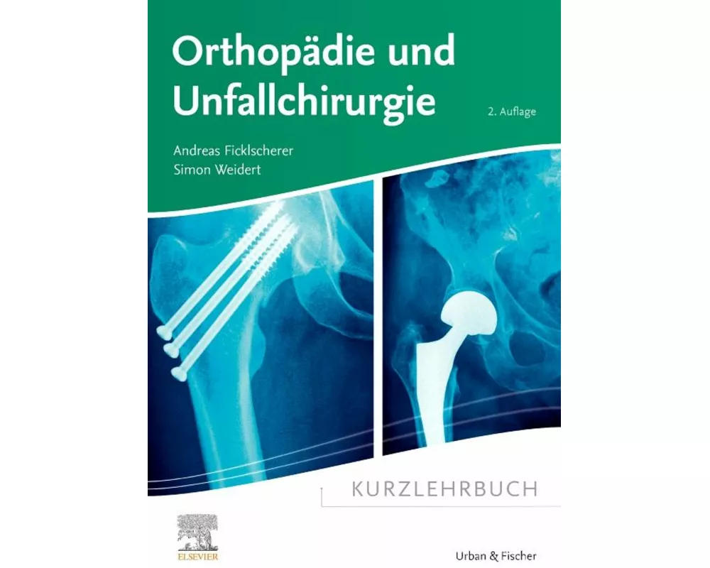 Kurzlehrbuch Orthopädie und Unfallchirurgie