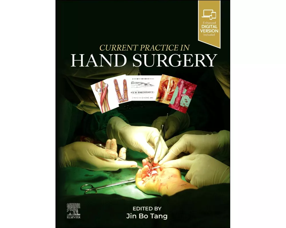 Current Practice in Hand Surgery