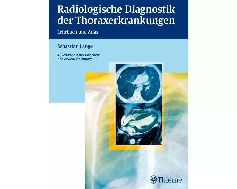 Radiologische Diagnostik der Thoraxerkrankungen