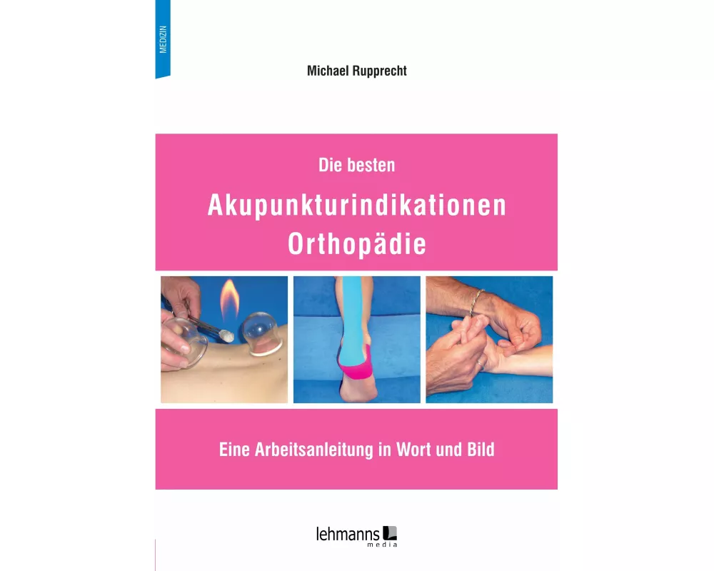 Die besten Akupunkturindikationen Orthopädie