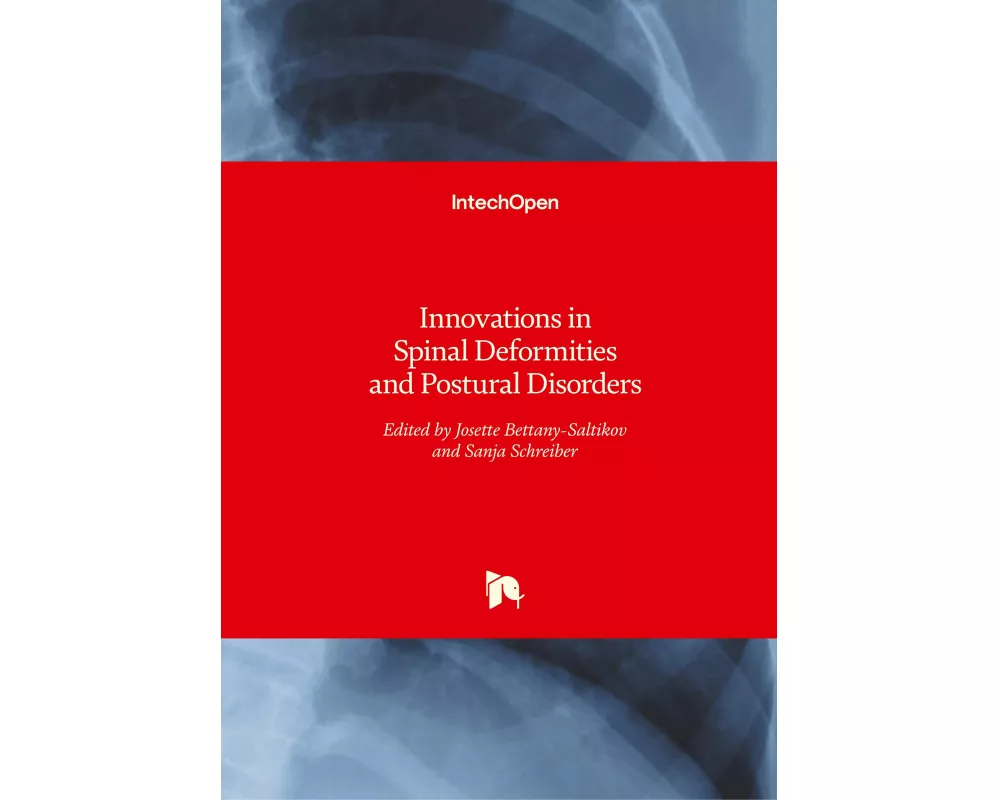 Innovations in Spinal Deformities and Postural Disorders