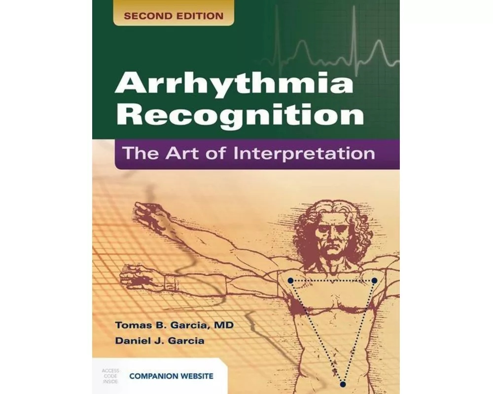 Arrhythmia Recognition: The Art Of Interpretation