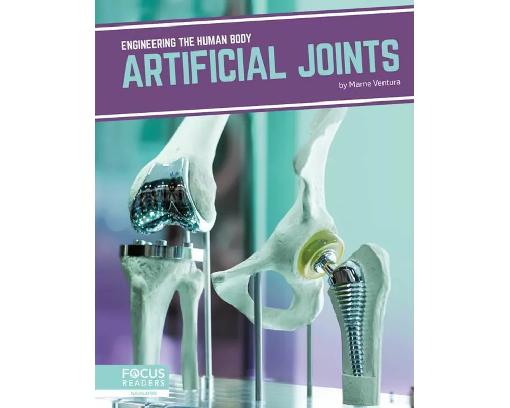 Artificial Joints