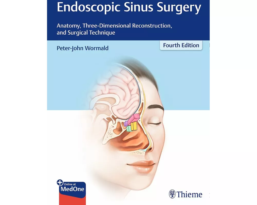 Endoscopic Sinus Surgery