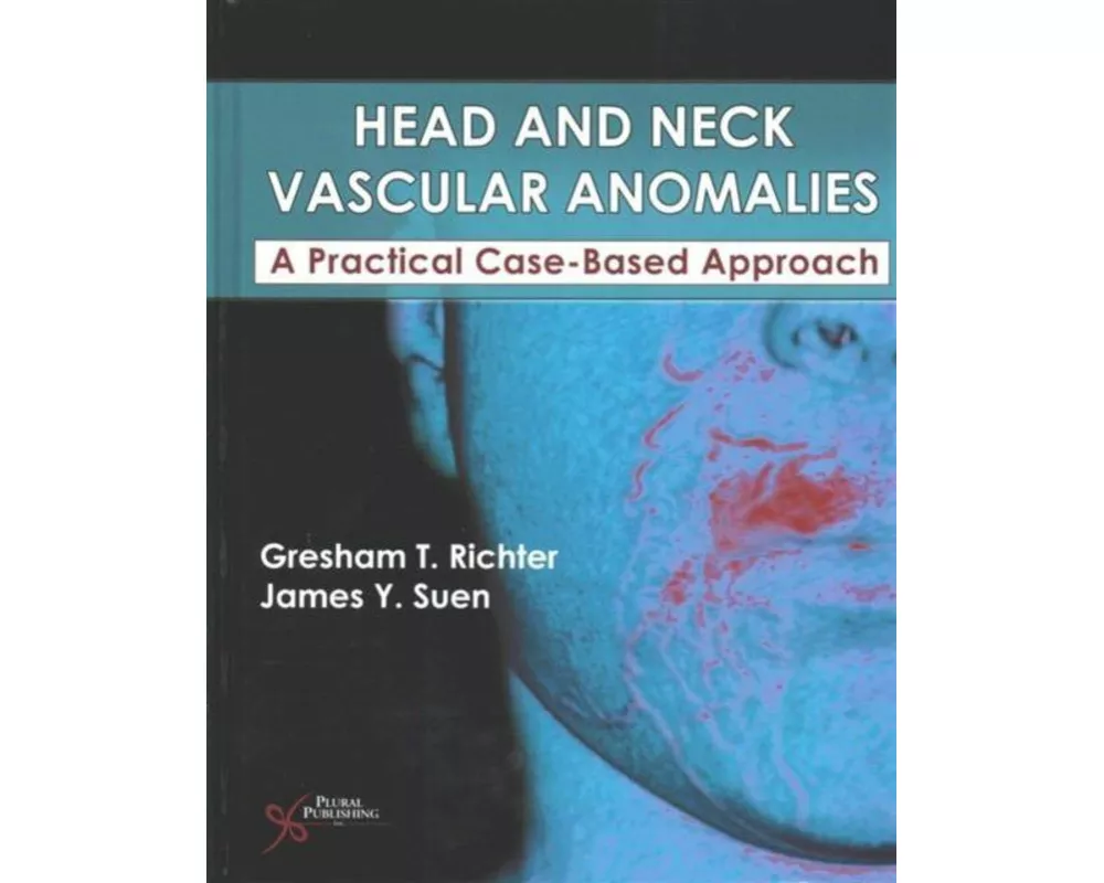 Head and Neck Vascular Anomalies