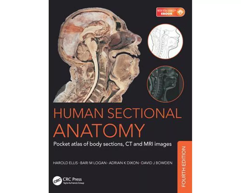 Human Sectional Anatomy
